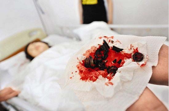 升降椅屡爆炸引白领恐慌 体重超过100公斤者慎